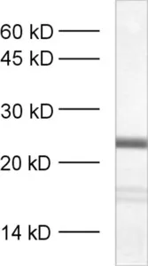 SNAP25 Polyclonal Guinea pig antiserum - image 1